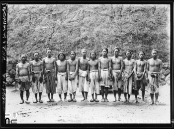 조선인 신체 측정 사진　/　원산 남자 정면 체격측정