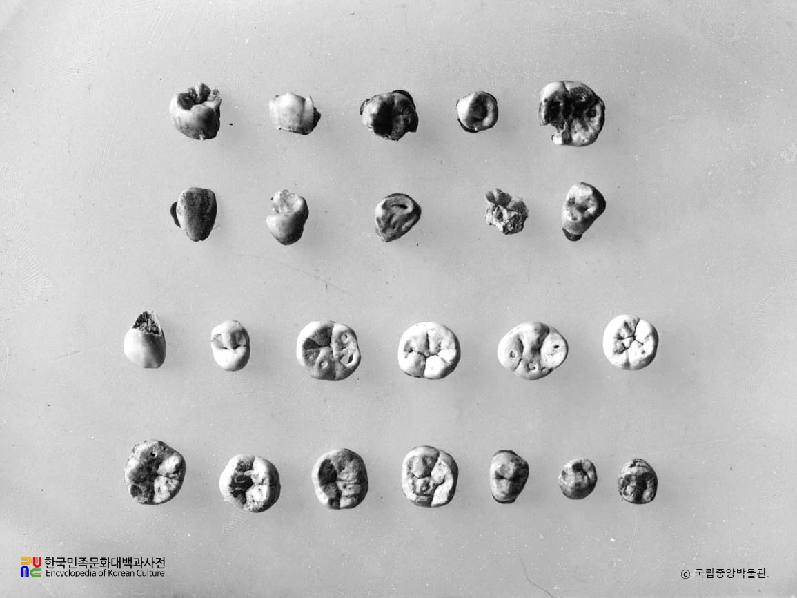 경남 양산 북정동 부부총 출토 피장자 치아